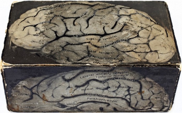Box Model of the brain, mid-20th-century