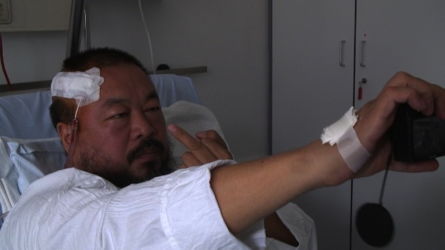 Ai Weiwei in hospital 